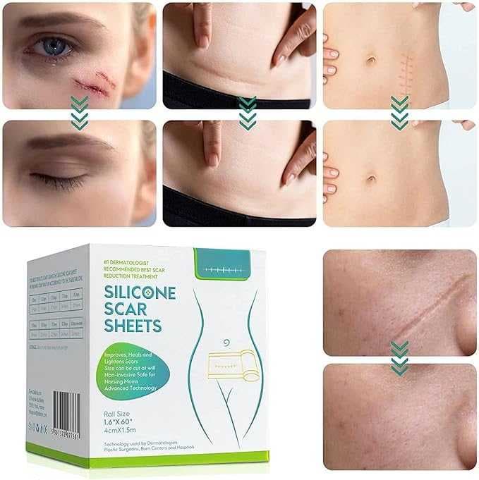 اوراق سيليكون للندبات