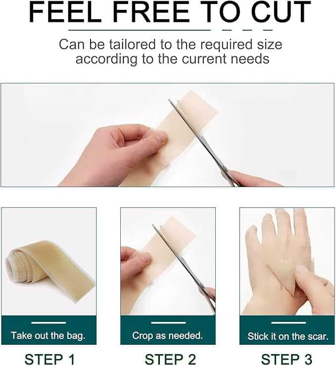 اوراق سيليكون للندبات